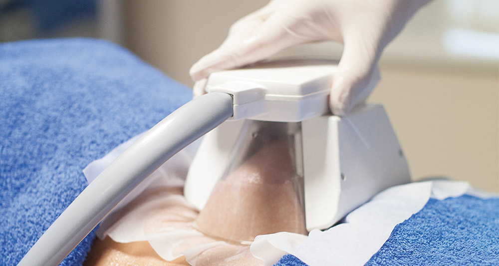 Multiple Areas in One Session HIFU and Fat Freezing Wisley