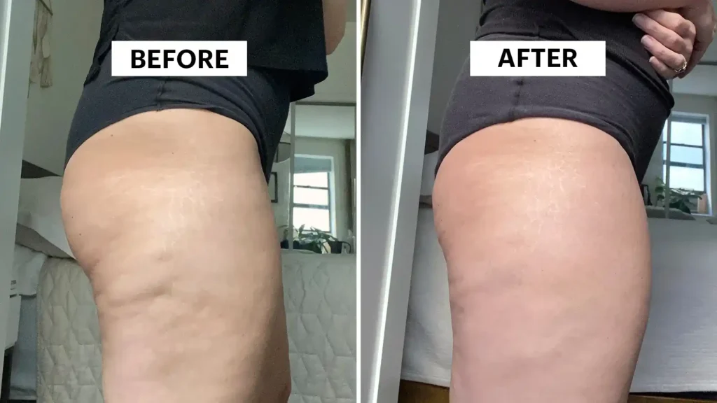 Do Toning Exercise Wisley Really Tackle Cellulite?
