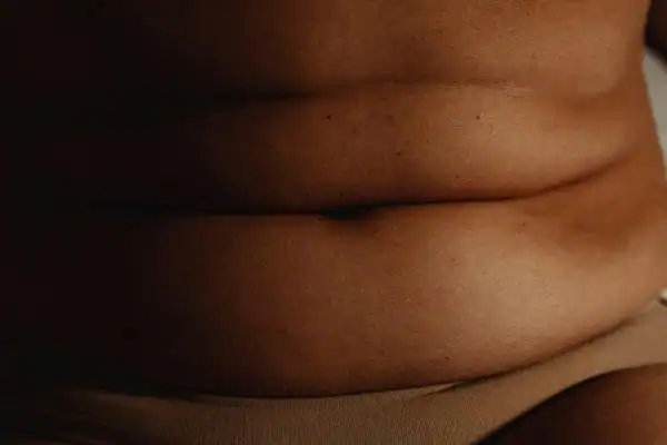 image of what stress can do on the stomach area and how Lipo 360 Wisley can help to change your body shape.